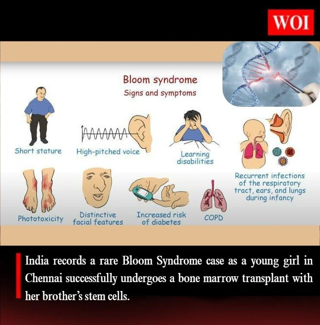 India Reports Rare Case of Bloom Syndrome: 12-Year-Old Undergoes Successful Bone Marrow Transplant