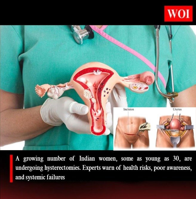 Rising Hysterectomy Surgeries Among Indian Women Spark Health Concerns